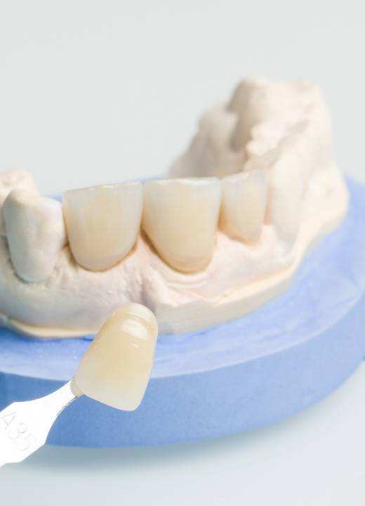 Tijuana Dental Costs